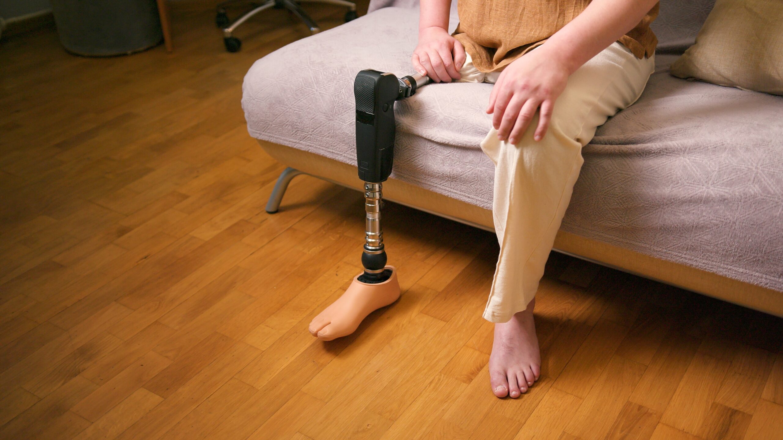 Person researching loss of limb compensation after a severe injury.